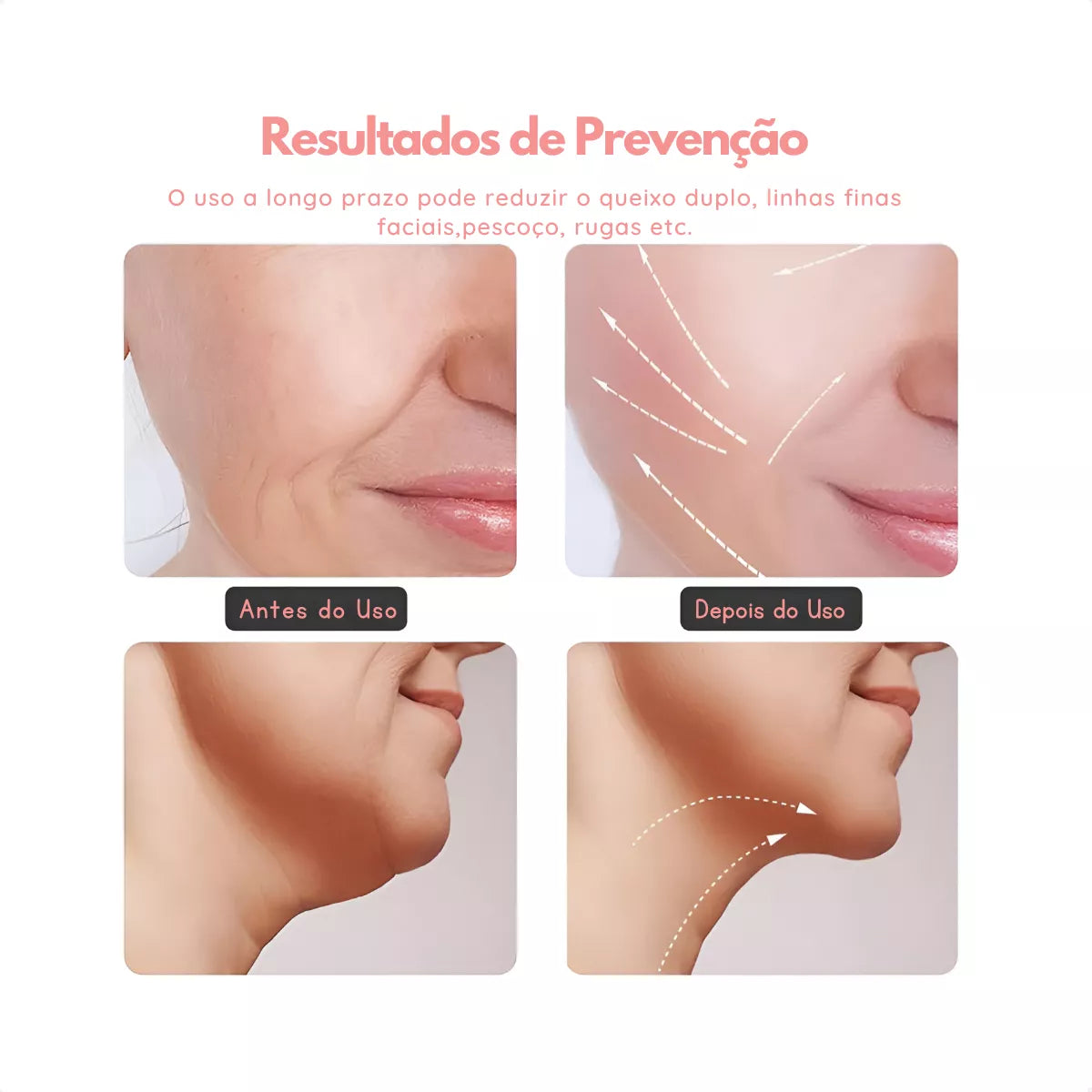 MASSAGEM FACIAL - Led Aparelho Tratamento Com Luz Bivolt EMS (Cores Sortidas)